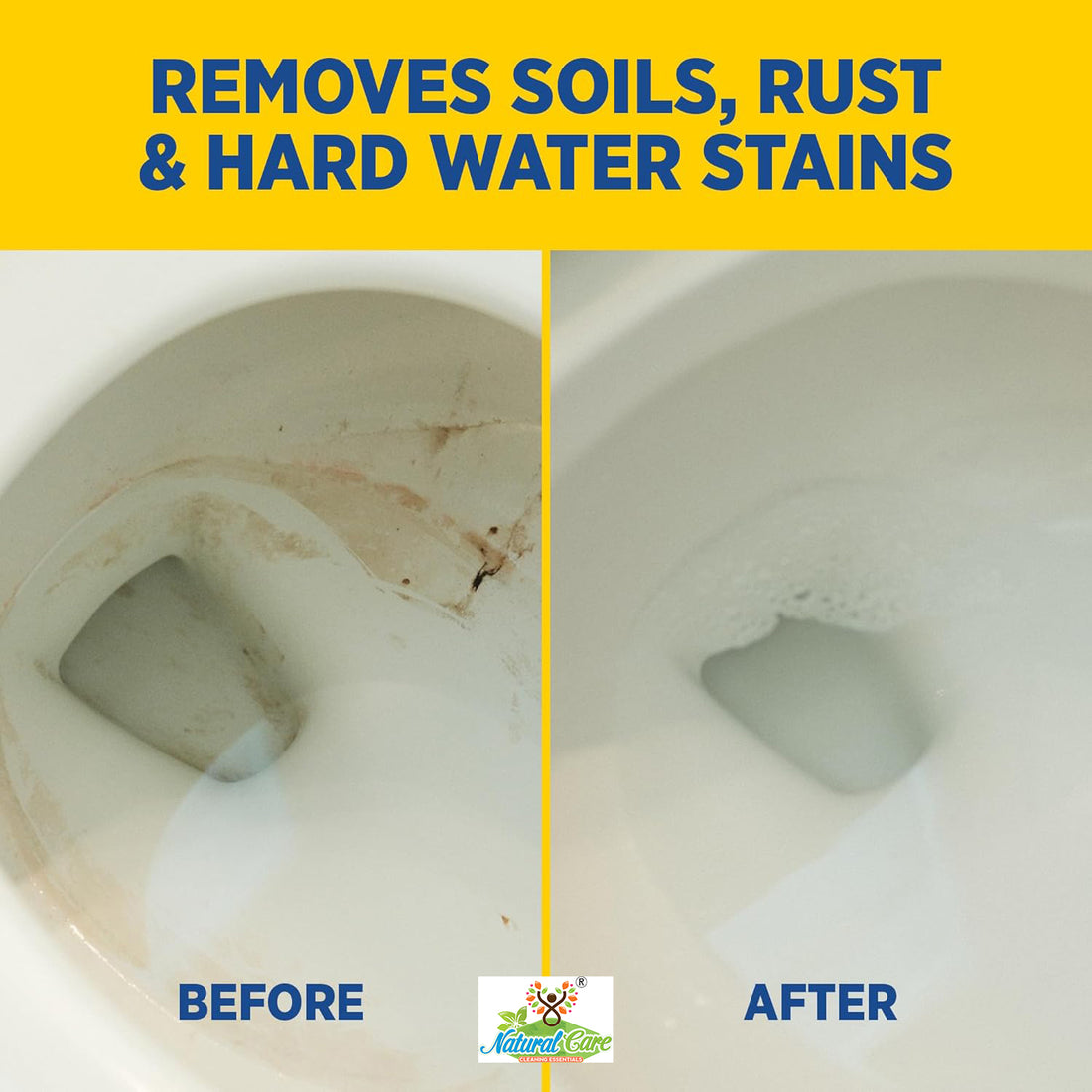 Natural Care Toilet Bowl Cleaner Liquid (Acid-Free) | Removes Limescale, Stains & Odour | Safe for Daily Use | 500 ml